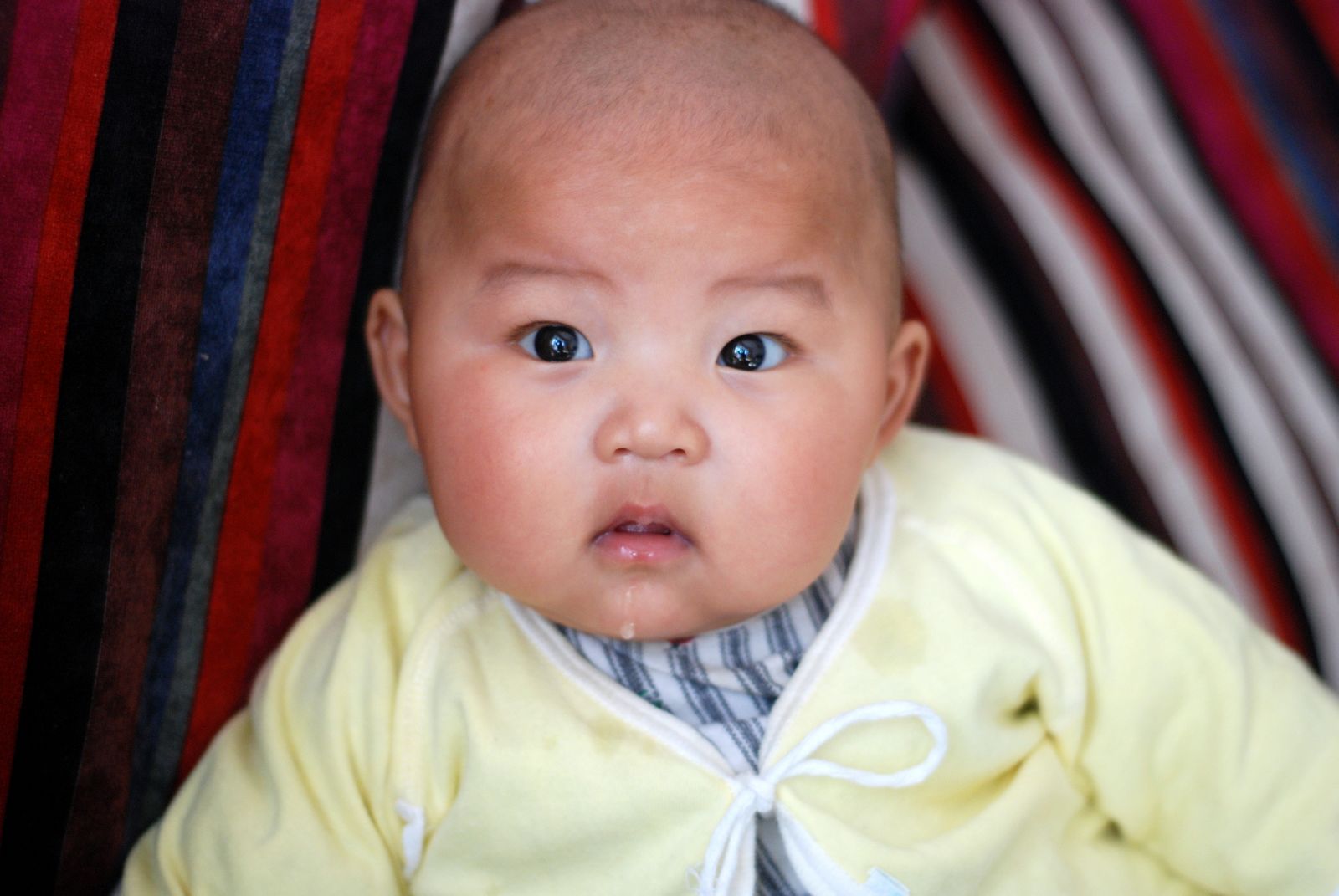 婴儿额头上有小白疙瘩（这6种疹子宝宝最容易患上）-幼儿百科-魔术铺